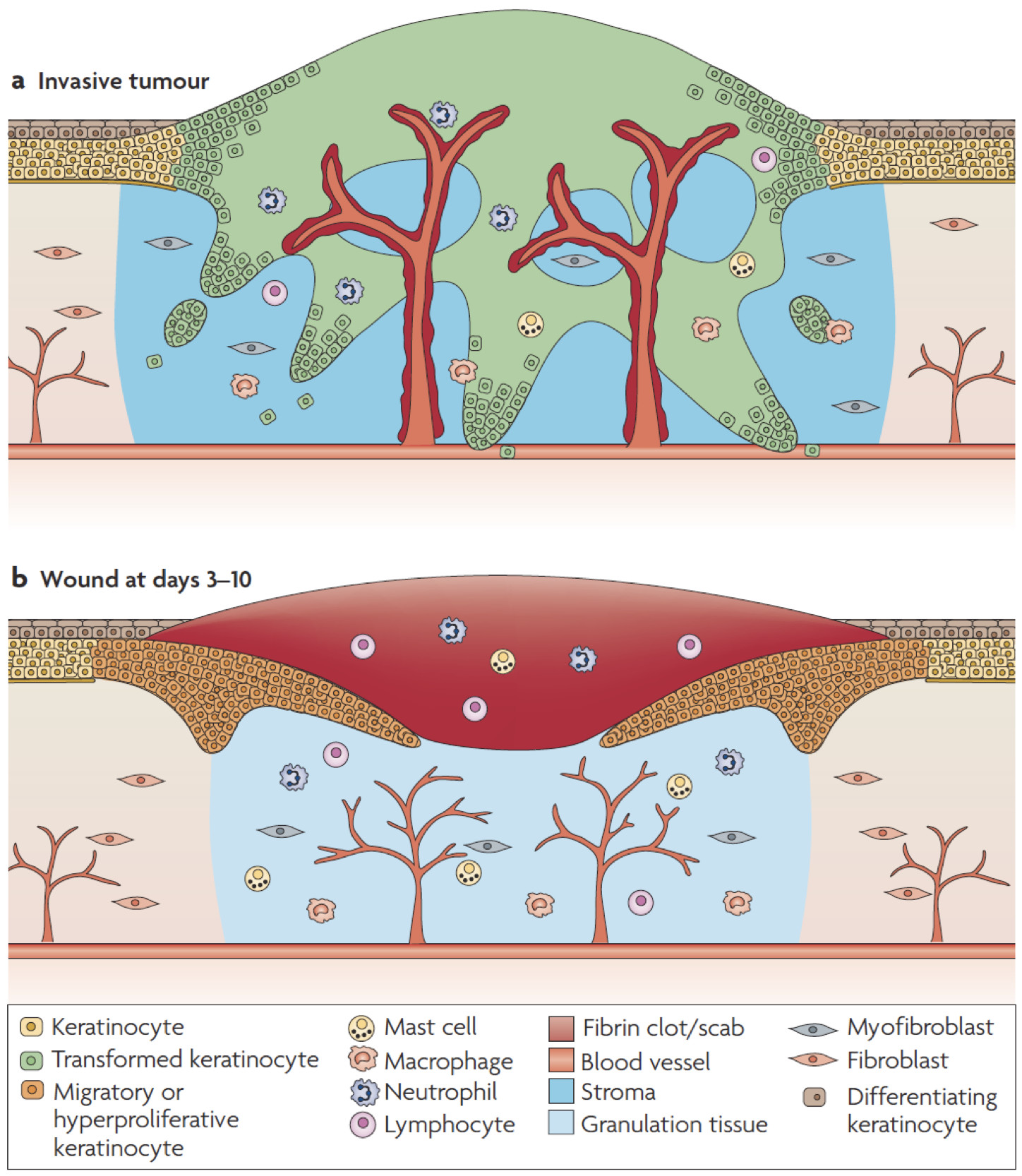 Enlarged view: Cancer as an overhealing wound